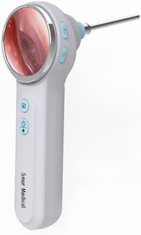 Smar Medical, Endoskopy, VOT-100, Czarny, oświetlenie LED, USB, Wi-Fi, praca bezprzewodowa